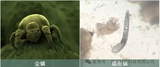 防螨！已成為健康的&ldquo;新剛需&rdquo;--武漢時間科技推出紡織品防螨整理劑喜化&reg;植螨零